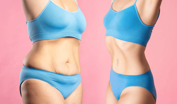 haus of contour body fat reduction endermologie